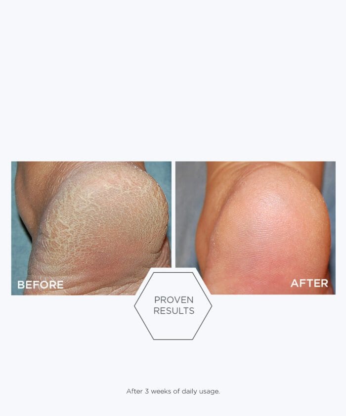 Neostrata Problem Dry Skin Cream 100 g - Billede 3