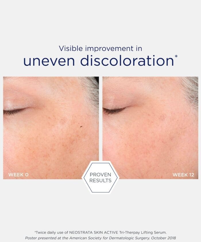 Neostrata Tri-Therapy Lifting Serum 30 ml - Billede 5