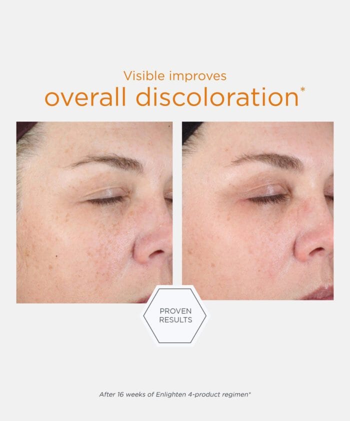 Neostrata Illuminating Serum 30 ml - Billede 3