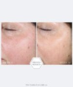 Neostrata PHA Renewal Pads 55 ml (60 pads) - Billede 3