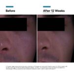 SkinCeuticals P-TIOX Anti-Wrinkle Cream 48 ml - Billede 7