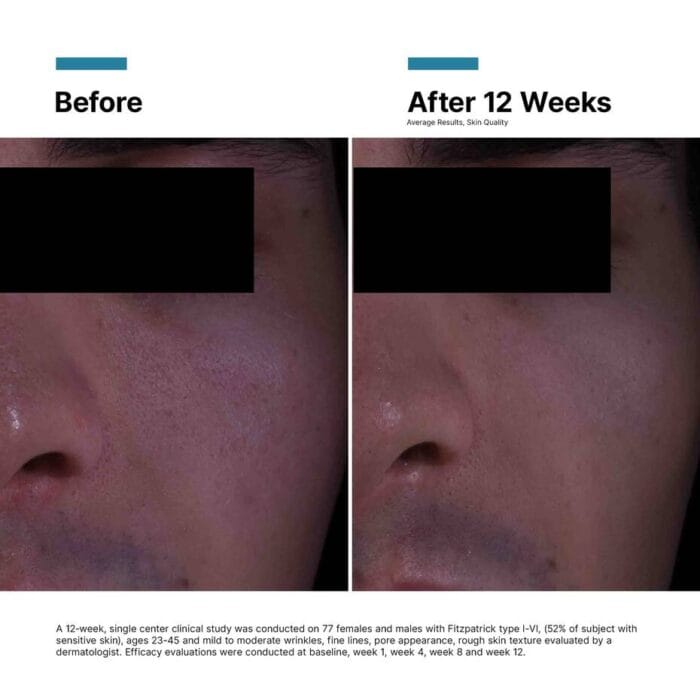 SkinCeuticals P-TIOX Anti-Wrinkle Cream 48 ml - Billede 7