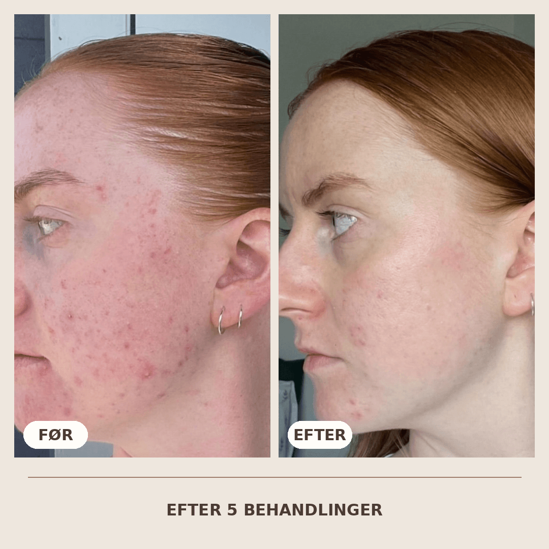 06_Resultat