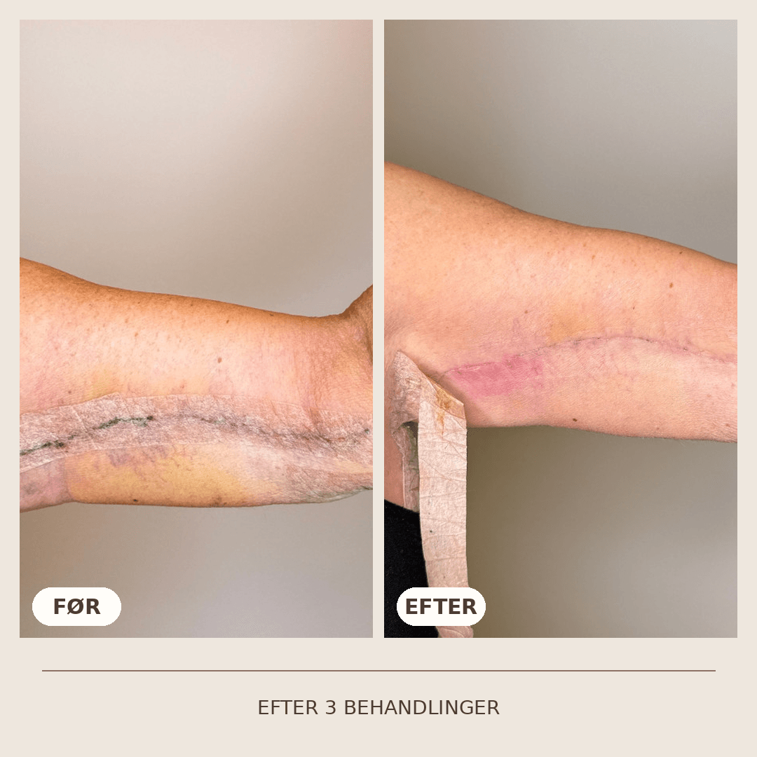 30_Dermalux